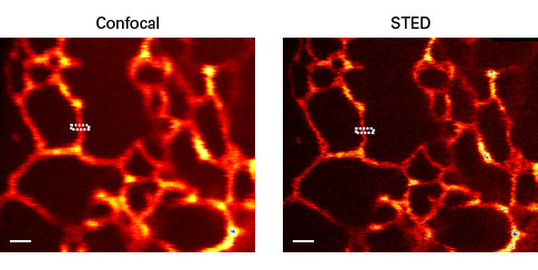 Mammalian endoplasmic reticulum labeled with E2-Crimson.