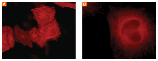 Cells expressing mCherry-actin and mCherry-tubulin.