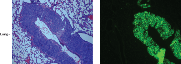 Metastatic lung tumor expressing ZsGreen1.