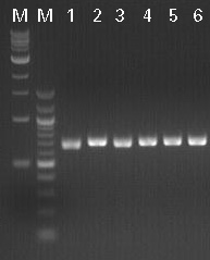 Figure 10. Agarose gel of colony PCR products directly from six clones.