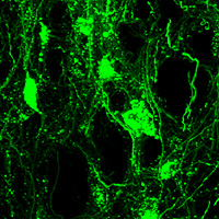 Mouse brain gene transduction