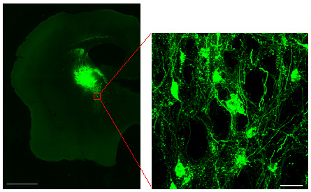 ZsGreen1 expression in a coronal brain section. The left panel shows the entire brain section (scale bar, 1 mm); strong fluorescence in the striatum is noted. The right panel is an enlargement of a portion of panel A (scale bar, 30 µm), showing expression in the globus pallidus. Data credit: Prof. Muramatsu Shinichi (Jichi Medical School).