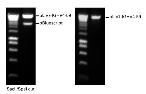 Amplification and cloning of a human IGHV into expression vector