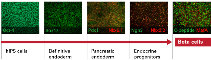 hiPSC-derived beta cell differentiation