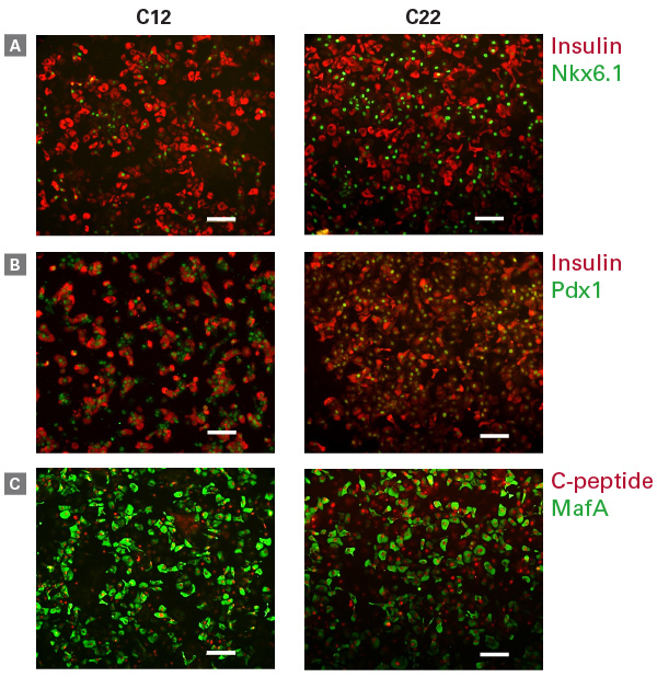 hiPS cell-derived beta cells coexpress key beta cell proteins