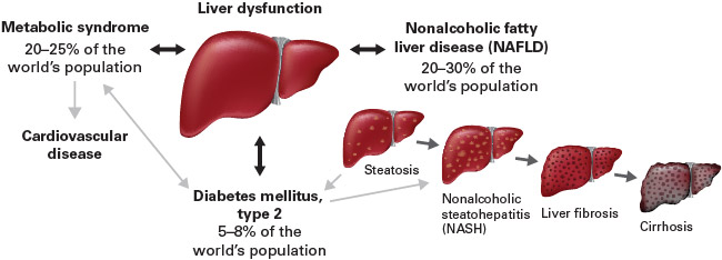 The relationships between metabolic diseases and liver dysfunction