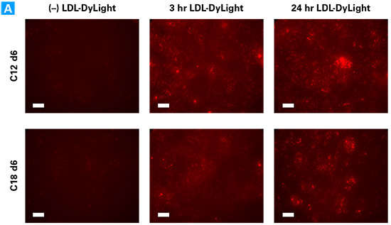 Enhanced hiPS-HEP cells demonstrate important features of lipid metabolism