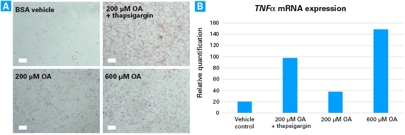 Accumulation of triglycerides and elevated levels of the inflammation marker TNFα upon induction of steatosis