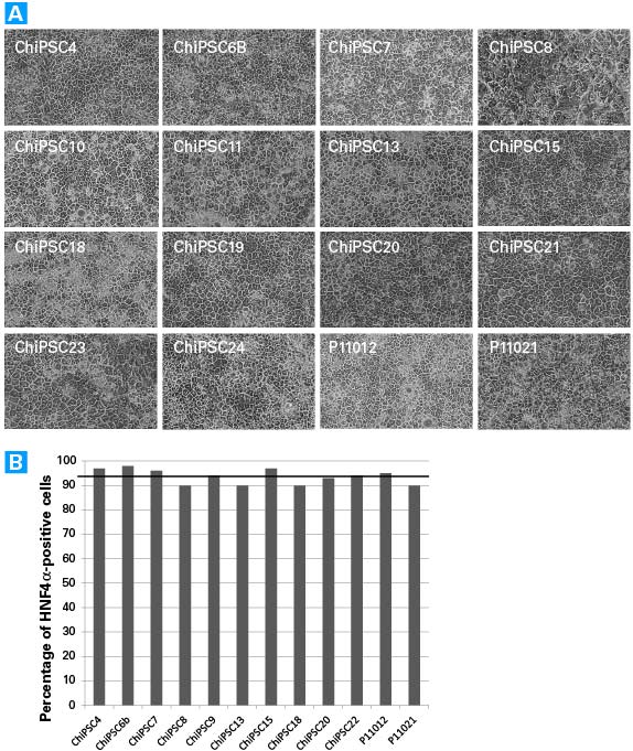 iPS cell donor-dervied hepatocyte morphology