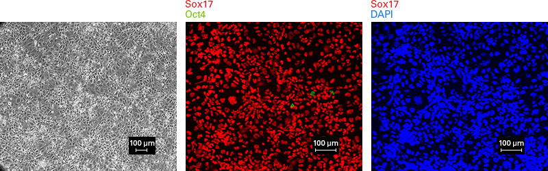 Differentiation to DE shown by morphology and Sox17, Oct4 markers