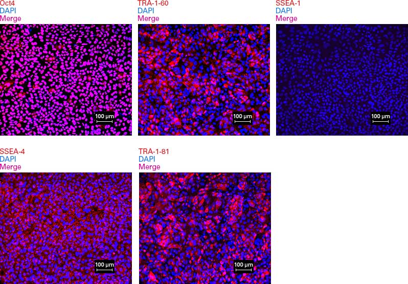 Immunocytochemical detection of stem cell markers in an iPS cell line