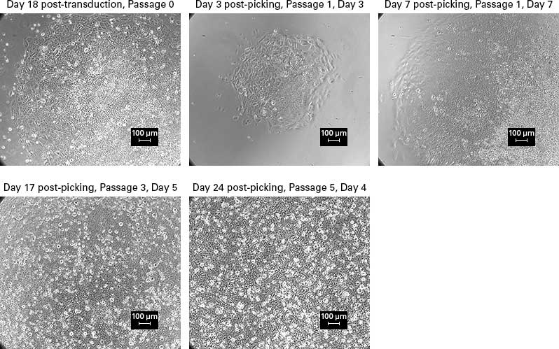 Morphological changes of a colony from picking to freezing 