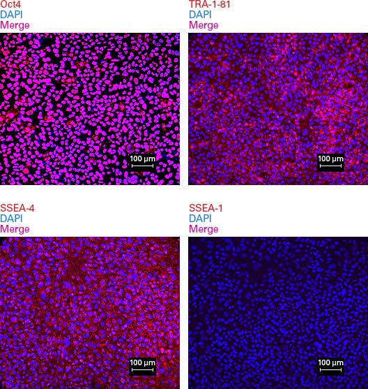 Immunocytochemical detection of stem cell markers in an iPS cell line