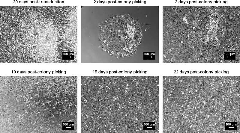 Morphological changes of a colony from picking to freezing