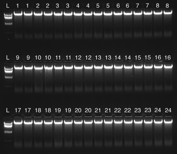 Isolation of high-integrity DNA from human blood