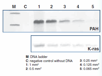 DNA purification from microdissected FFPE tissue