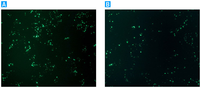 Transfection efficiencies with NucleoBond Xtra Maxi vs. a competitor