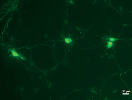 NucleoBond Xtra Maxi EF-purified plasmid transfects primary neurons