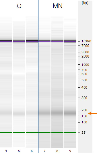 Optimized protocol for cfDNA isolation