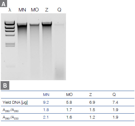 Higher quality DNA and better yields with NucleoSpin DNA Stool