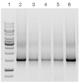 Efficient removal of PCR inhibitors from different stool sample sources