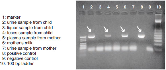 Detection of CMV virus 