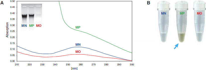 Total DNA from forest soil was purified with NucleoSpin Soil (MN) and competitor kits (MP and MO).