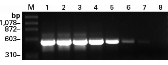 Superior sensitivity of Titanium One-Step RT-PCR