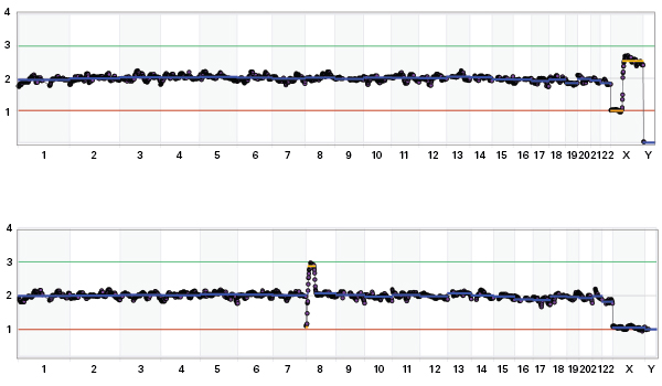 Segmental aneuploidy detection using the Embgenix PGT-A Kit