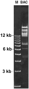 Restriction digest of a BAC clone (163-kb insert) purified using the NucleoBond BAC 100 kit