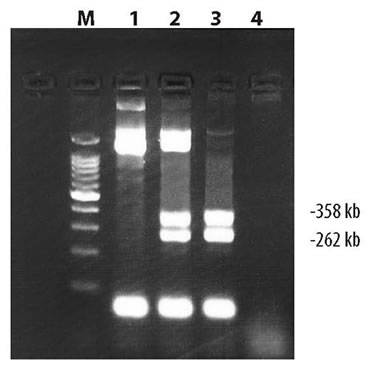 Amplification of the Huntington's Disease (HD) gene using Takara LA Taq DNA Polymerase